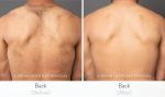 Before and After Image