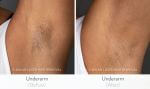Before and After Image